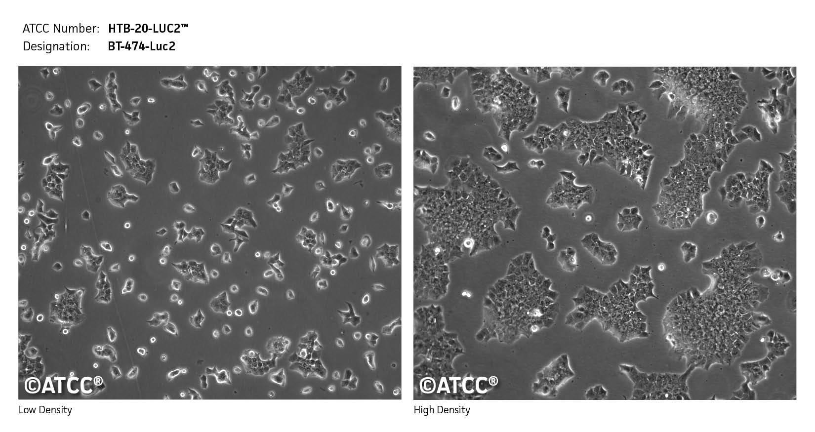 Cell Micrograph HTB-20-LUC2