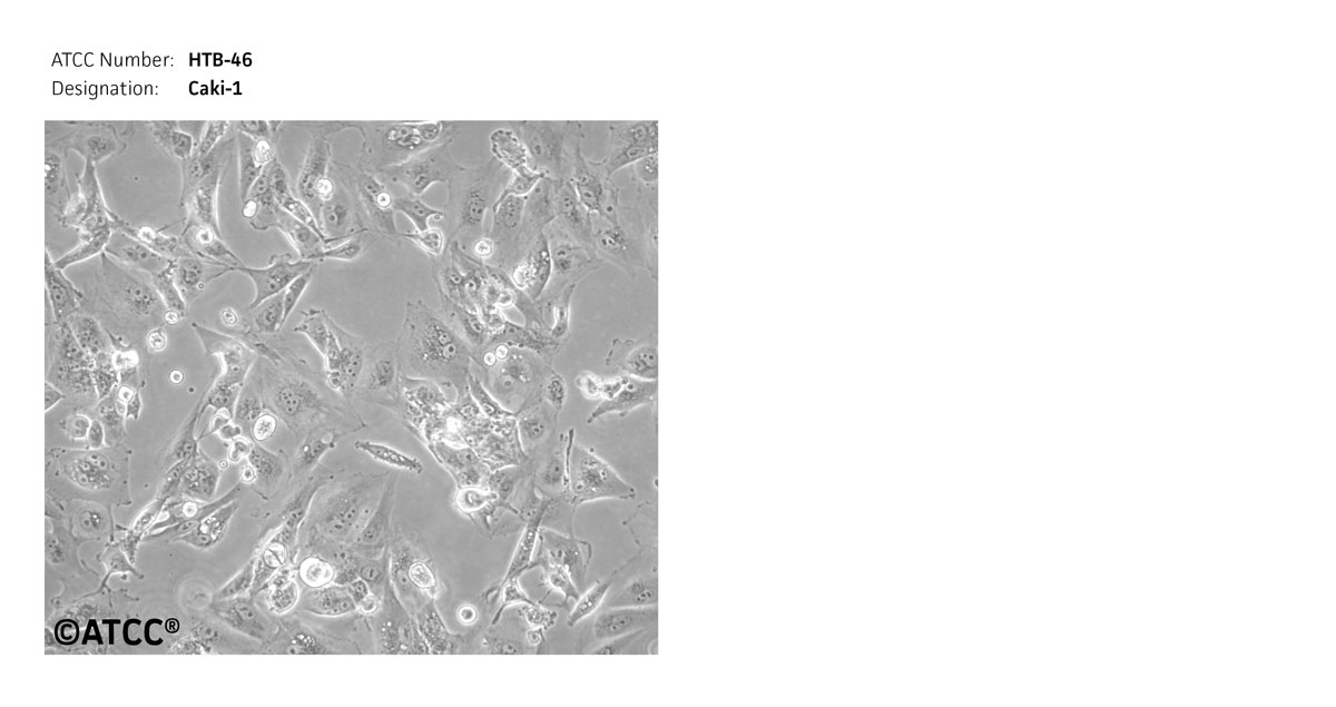 Caki-1 clear cell carcinoma, ATCC HTB-46 Cell Microcgraph