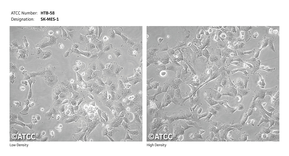 SK-Hep-1 Cell Lines Complete Growth Medium