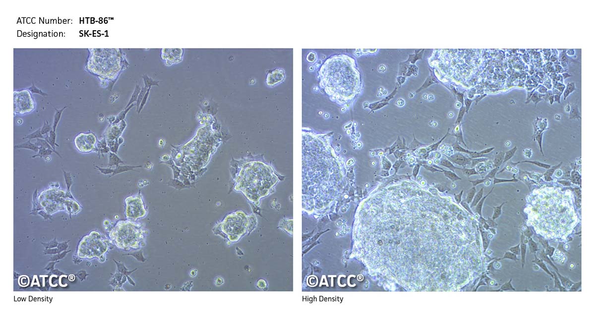 Cell Micrograph SK-ES-1