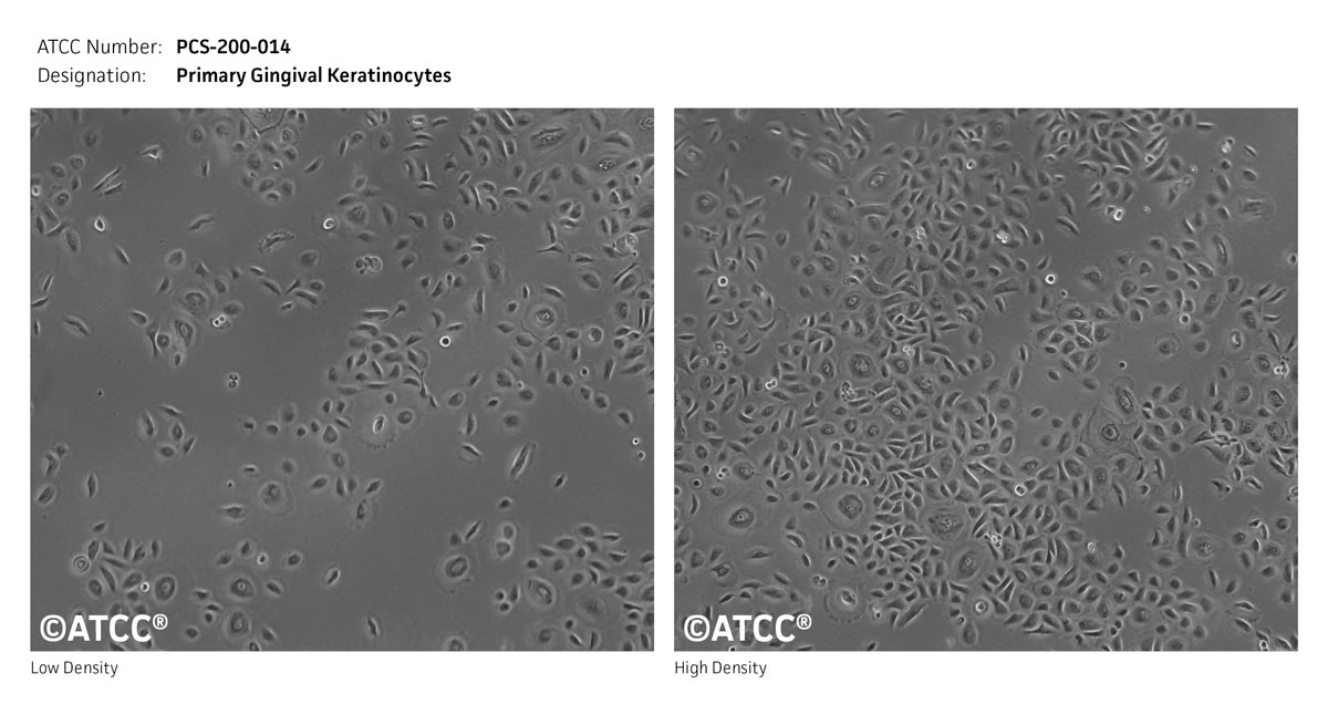 Cell Micrograph of ATCC PCS-200-014