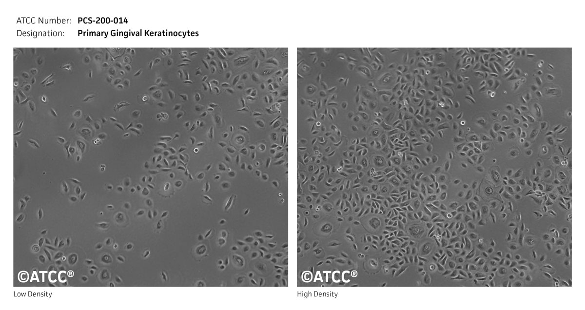 Primary Gingival Keratinocytes PCS200014 ATCC
