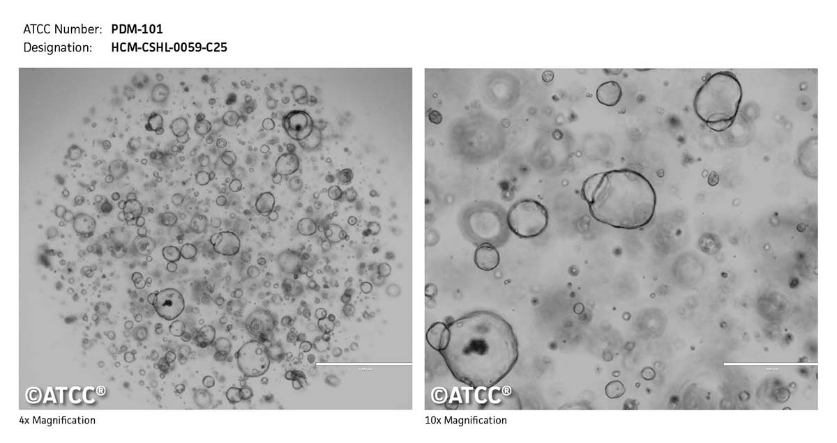 Micrograph of PDM-101