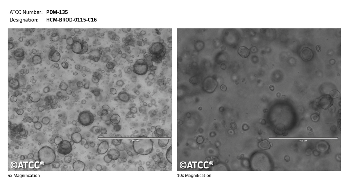 PDM-135 micrograph