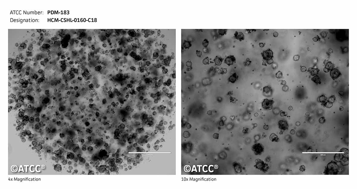 ATCC PDM-183 Cell Micrograph