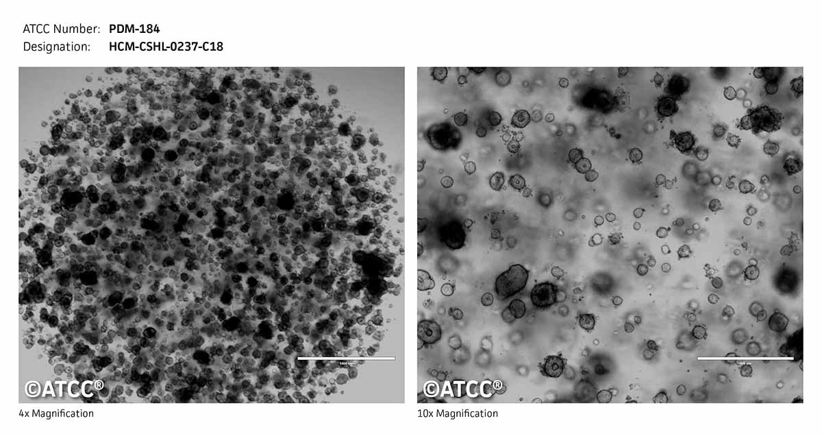 ATCC PDM-184 Cell Micrograph