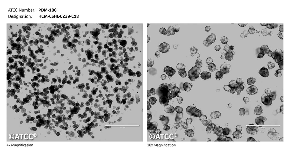 ATCC PDM-186 Cell Micrograph