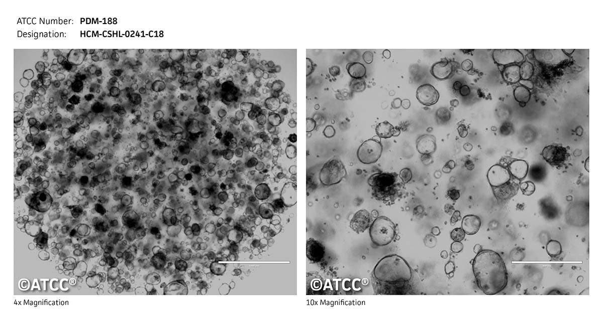 ATCC PDM-188 Cell Micrograph