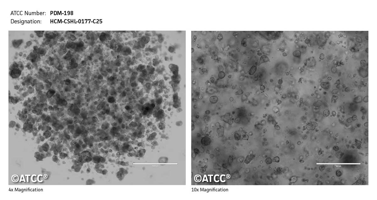 Micrograph of PDM-198