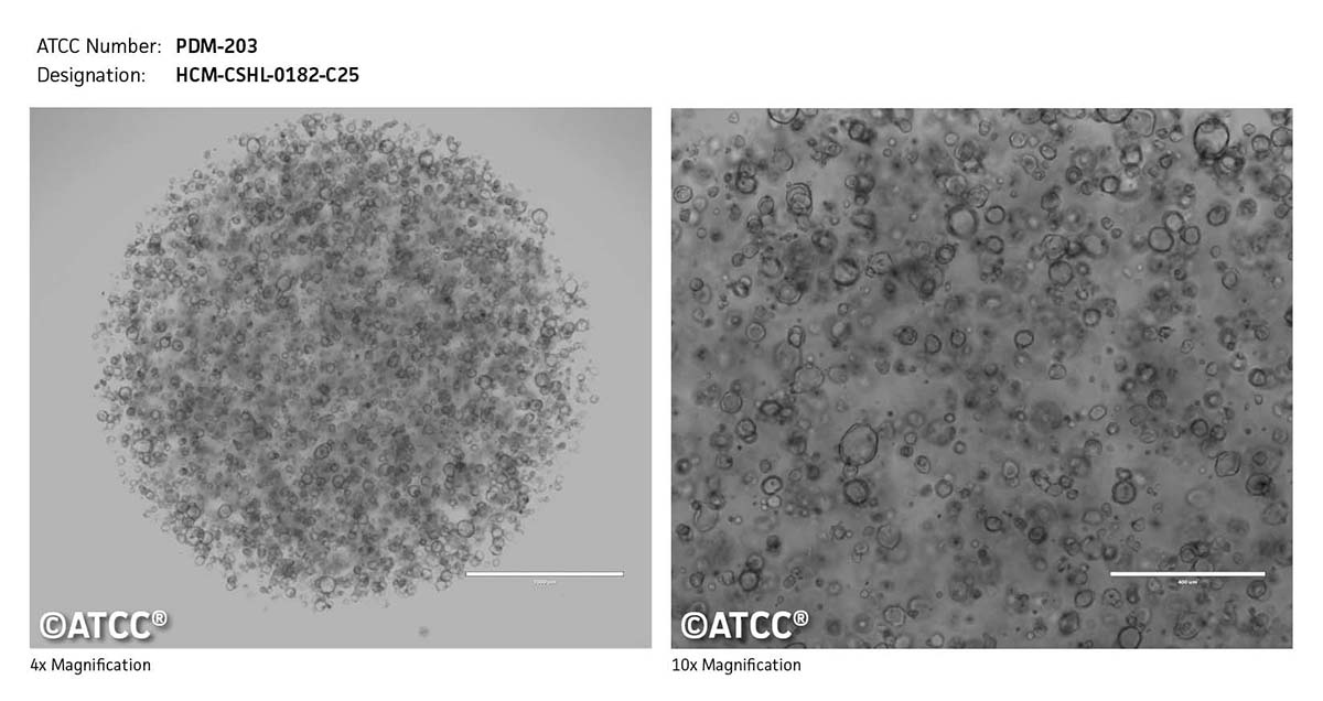 Cell micrograph of ATCC PDM-203
