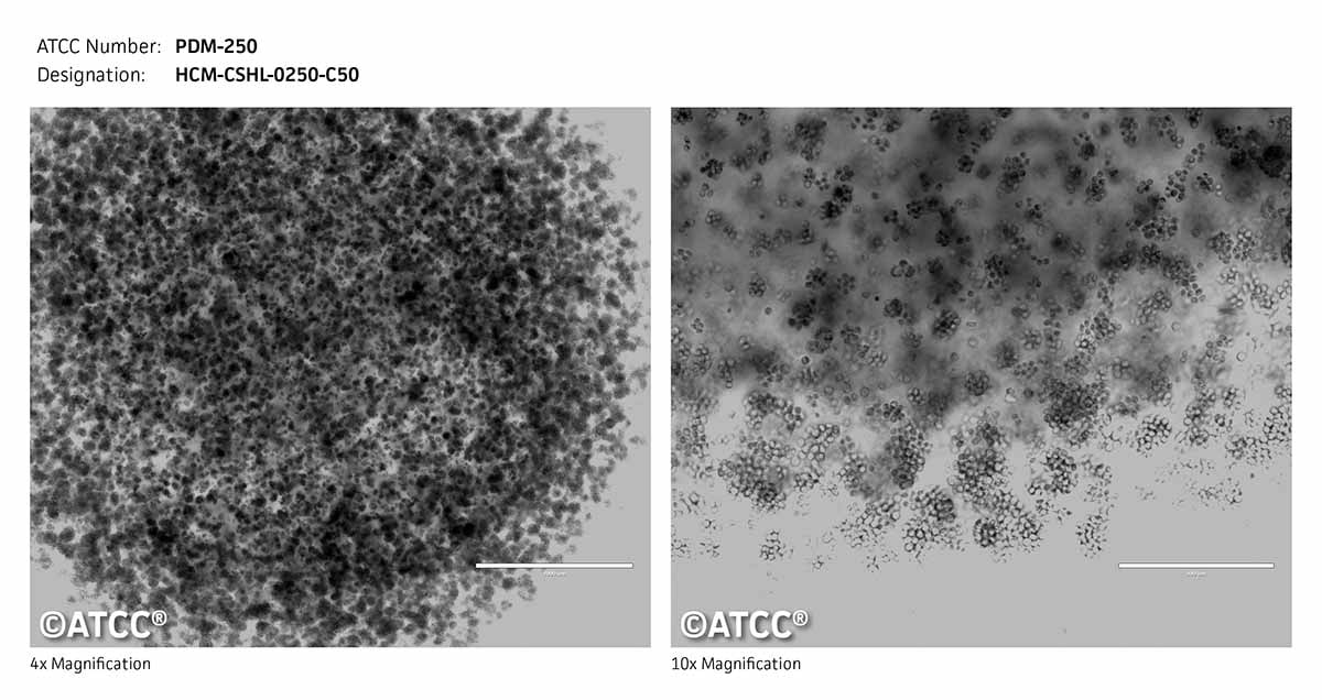 ATCC PDM-250 Cell Micrograph