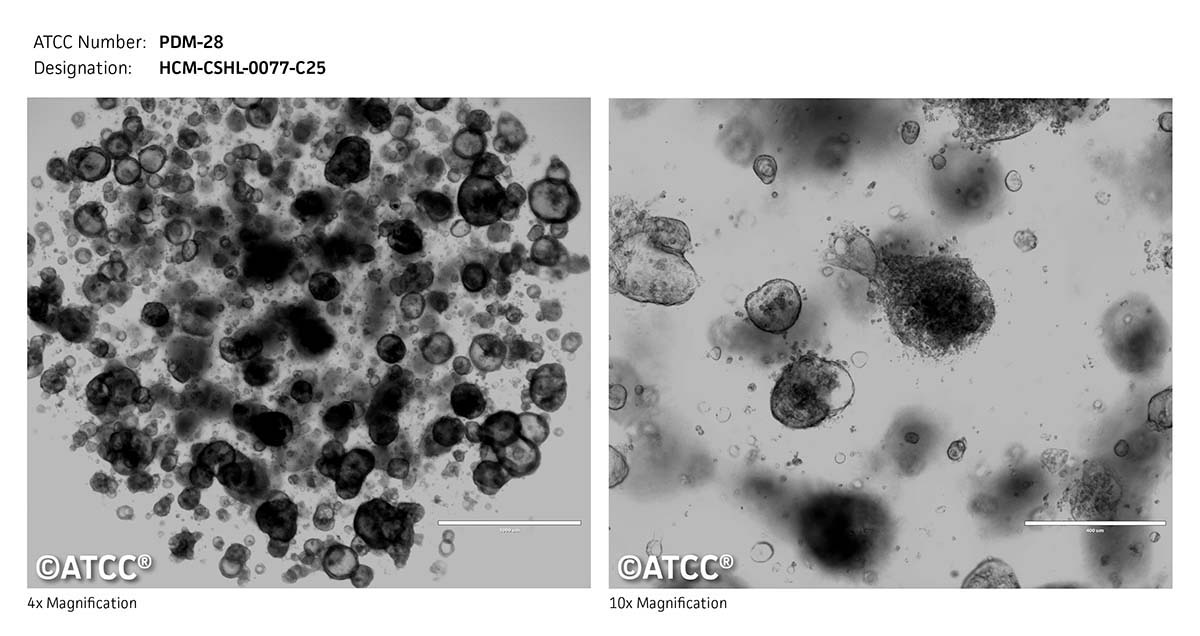 ATCC PDM-28 Cell Micrograph