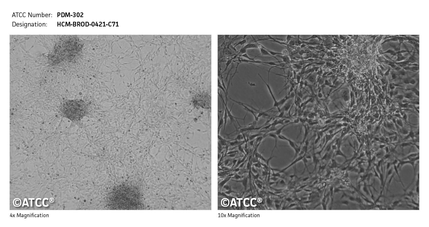 ATCC PDM-302 Cell Micrograph