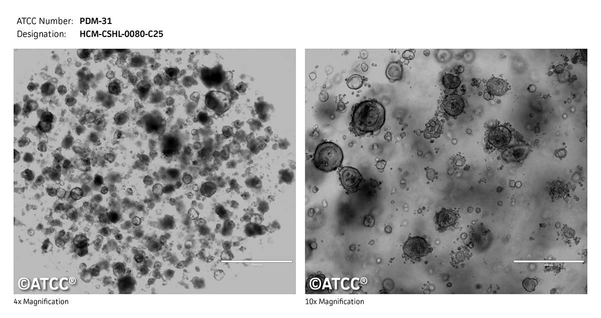 ATCC PDM-31 Cell Micrograph