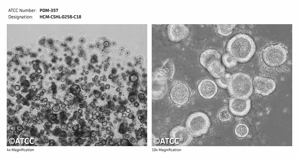 Micrograph ATCC PDM-357