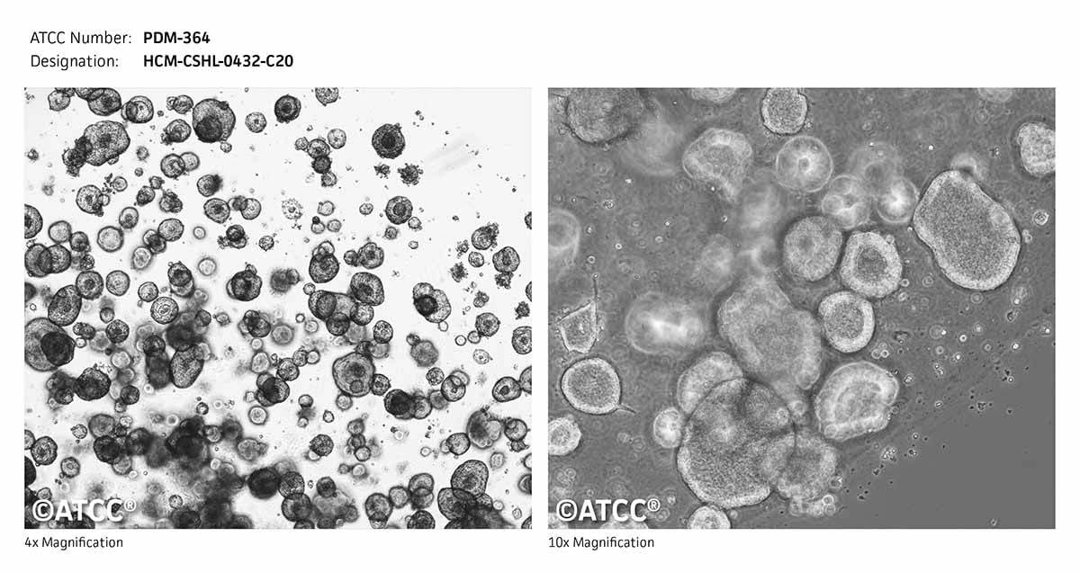 ATCC PDM-364 Cell Micrograph