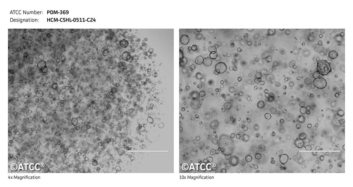 ATCC PDM-369 Cell Micrograph