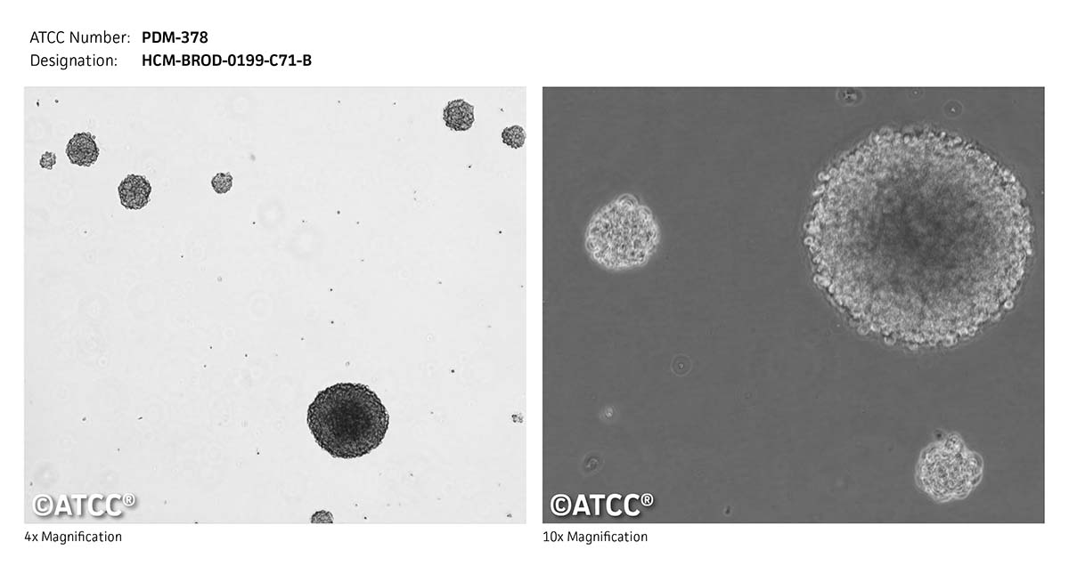 Micrograph of PDM-378