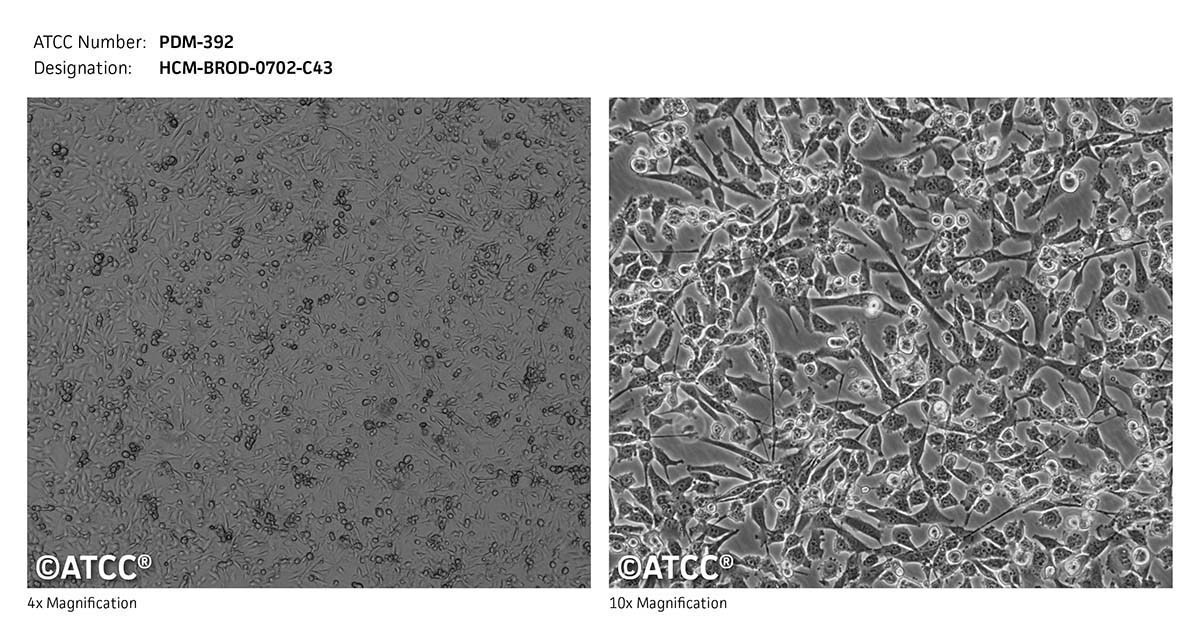 ATCC PDM-392 Cell Micrograph