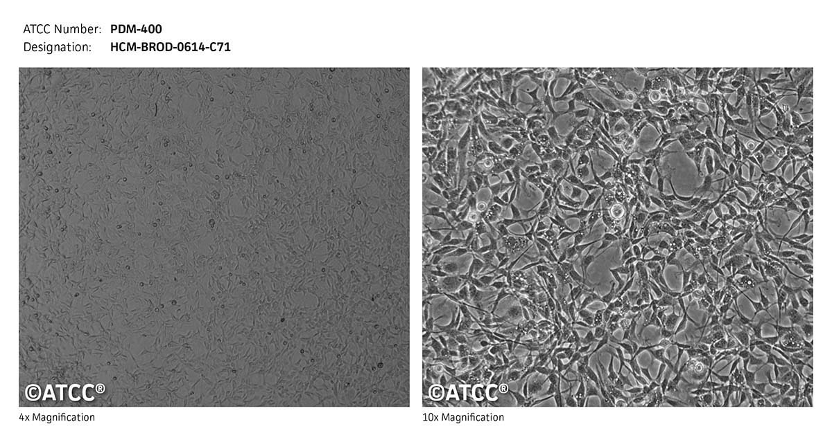 ATCC PDM-400 Cell Micrograph