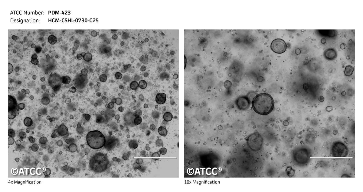 ATCC PDM-423 Cell Micrograph