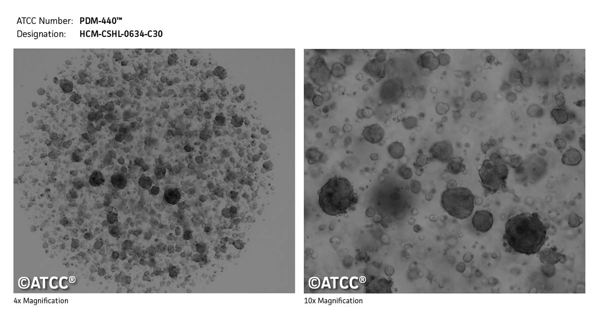 Cell micrograph of PDM-440