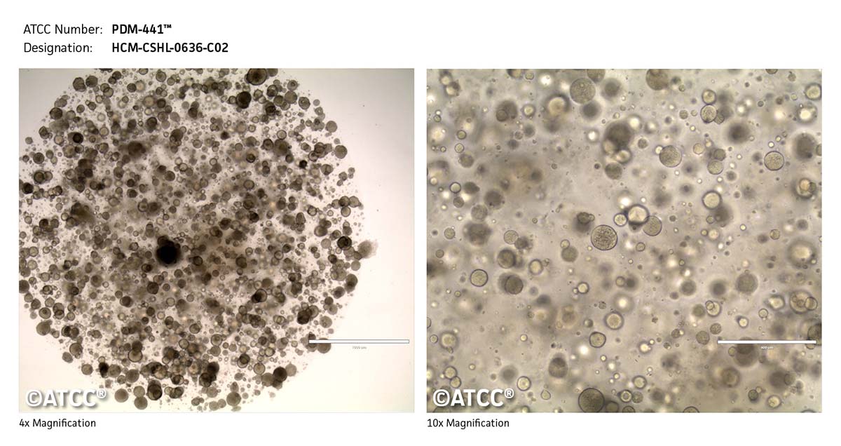 Cell Micrograph PDM-441