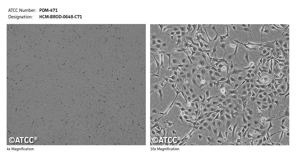 Micrograph of PDM-471