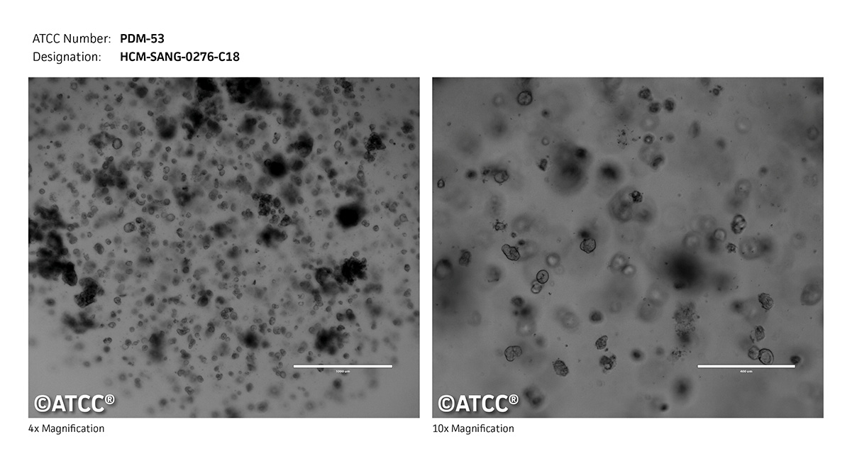 HCM SANG 0276 C18 PDM 53 ATCC