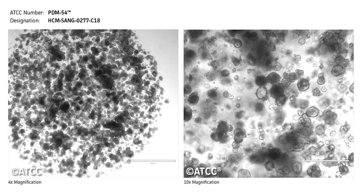 HCM SANG 0277 C18 PDM 54 ATCC