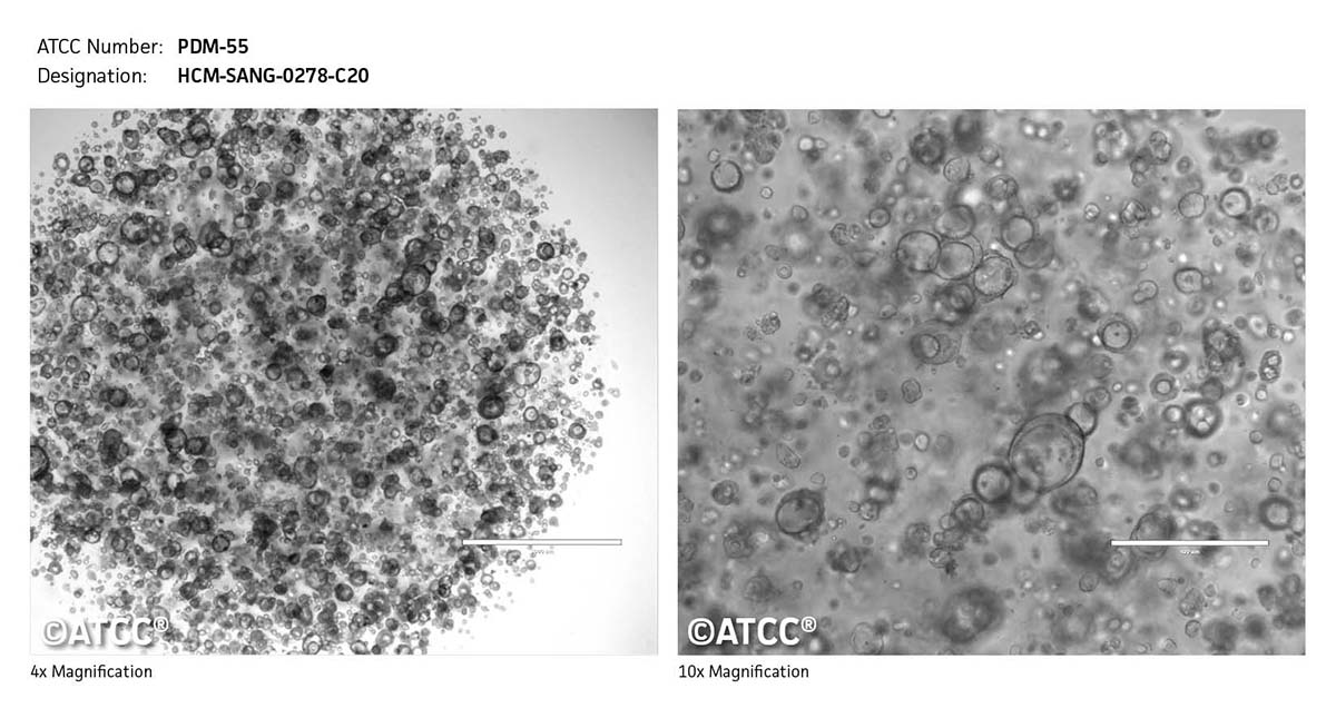 Cell micrograph of ATCC PDM-55