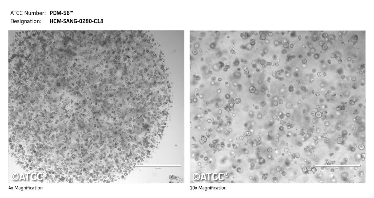 Cell micrograph of PDM-56