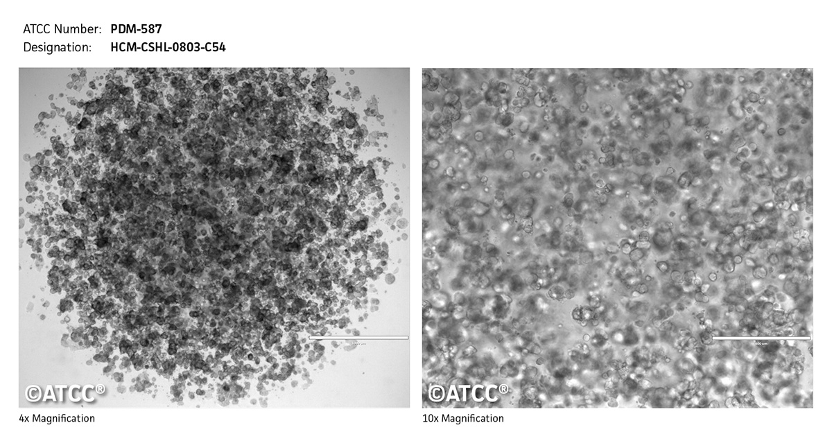 Cell micrograph PDM-587