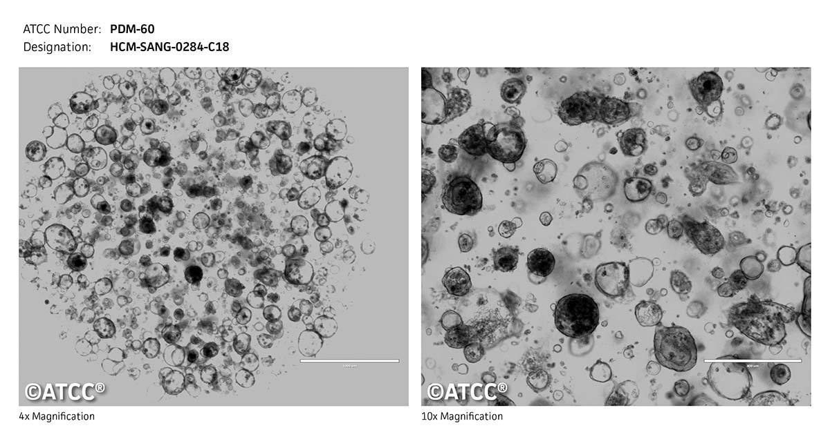 ATCC PDM-60 Cell Micrograph