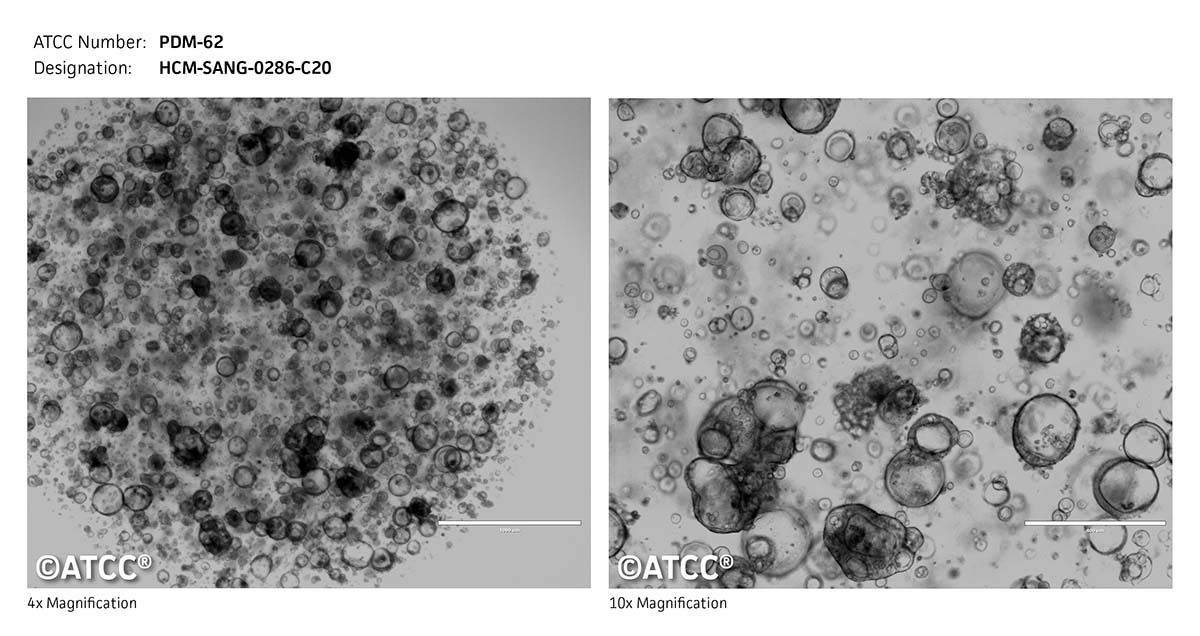 ATCC PDM-62 Cell Micrograph