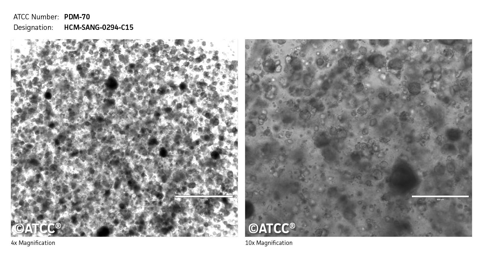 ATCC PDM-70 Cell Micrograph