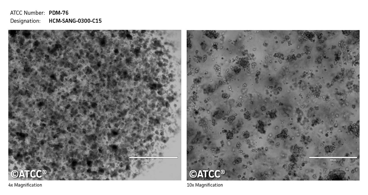 Cell Micrograph PDM-76