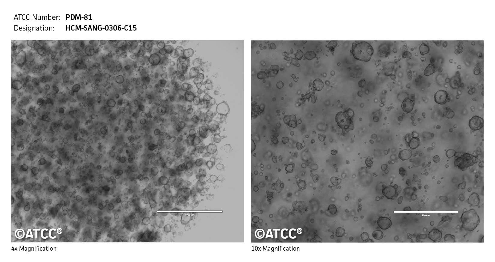 cell micrograph PDM-81