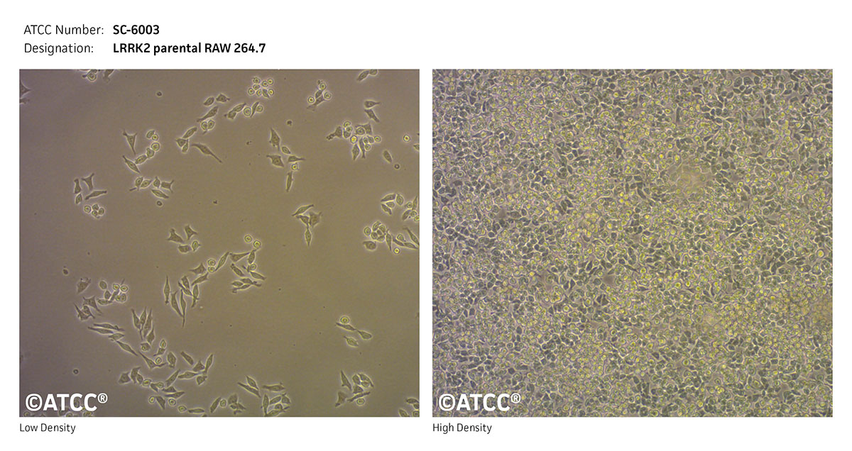 Cell Micrograph of LRRK2 Cells