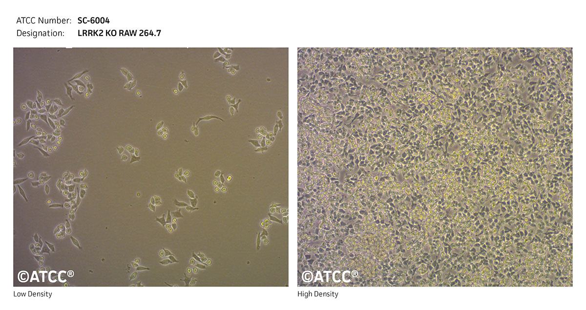 Cell Micrograph of LRRK2 KO Cells