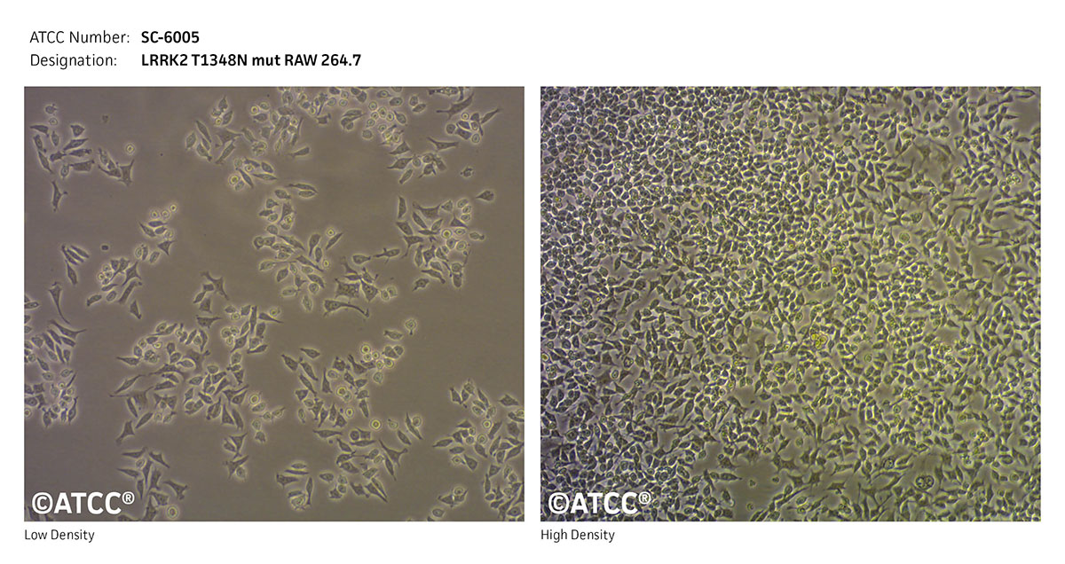 Cell Micrograph of LRRK2 T1348N Mut RAW 264.7 Cells