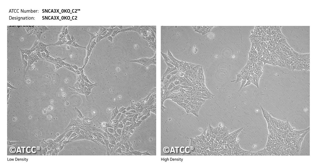 Cell micrograph of SNCA3X_0KO_C2 