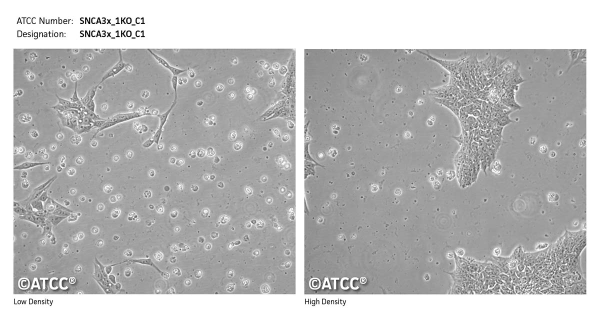 Cell micrograph SNCA3x_1KO_C1