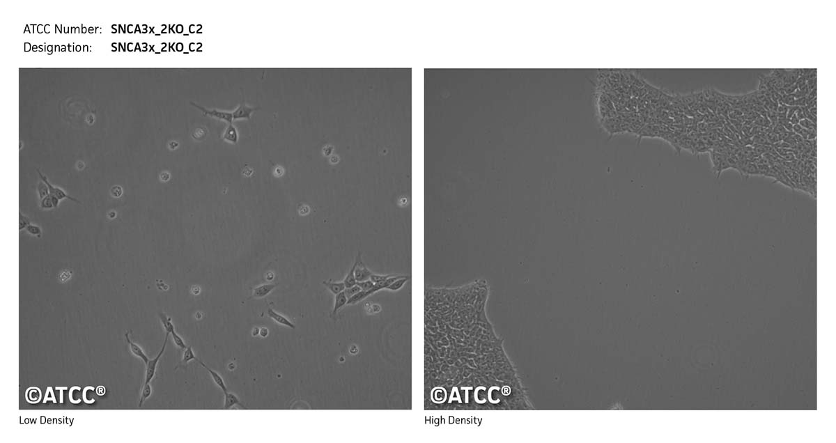 Cell micrograph SNCA3x_2KO_C2