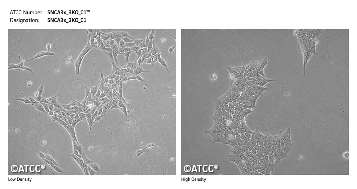 Cell micrograph of SNCA3x_3KO_C1 