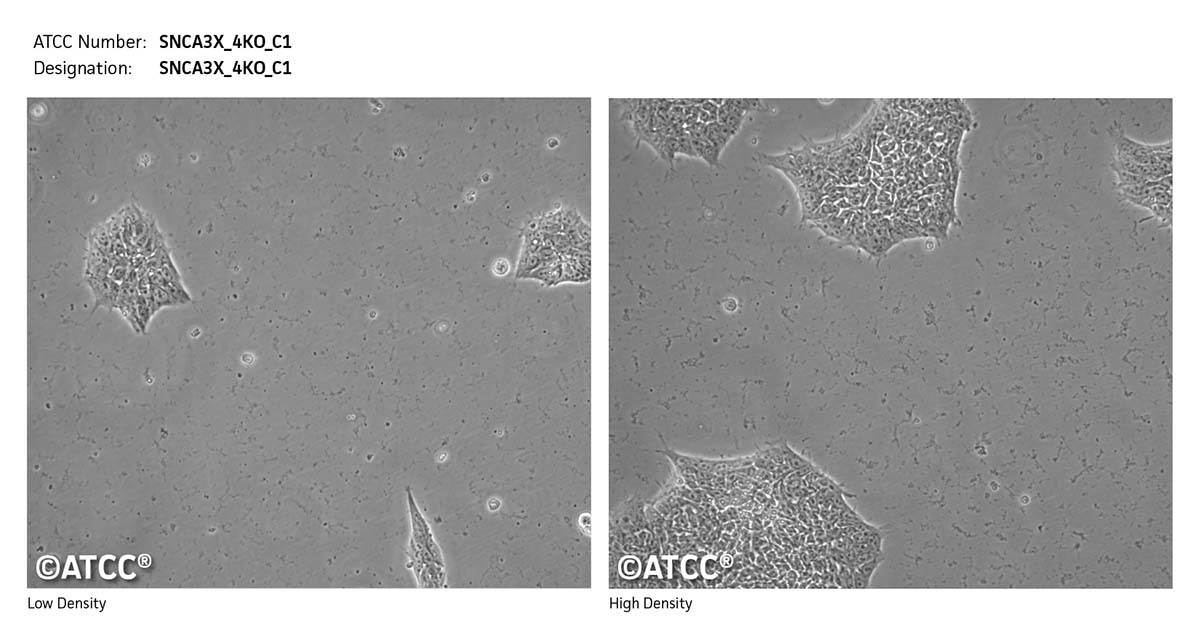 Cell micrograph SNCA3X_4KO_C1