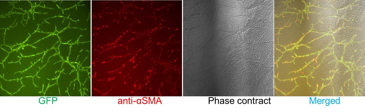 CRL-4054 TeloHaec-GFP co-cultured with hTERT MSC - Tubulogenesis