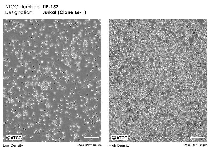 Jurkat, Clone E61 TIB152 ATCC