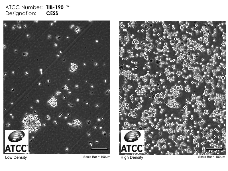 TIB-190 Micrograph