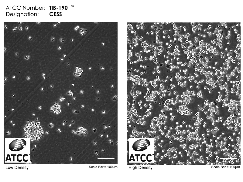 TIB-190 Micrograph